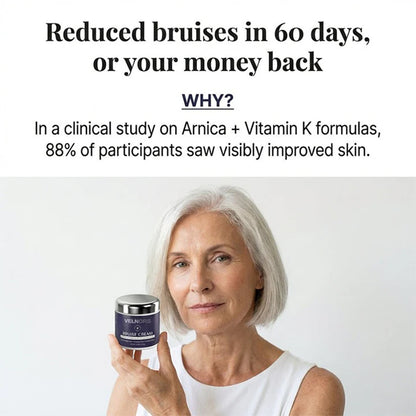 💥100K+ SOLD💕- VELNORS® Bruise Repair & Skin-Strengthening Cream