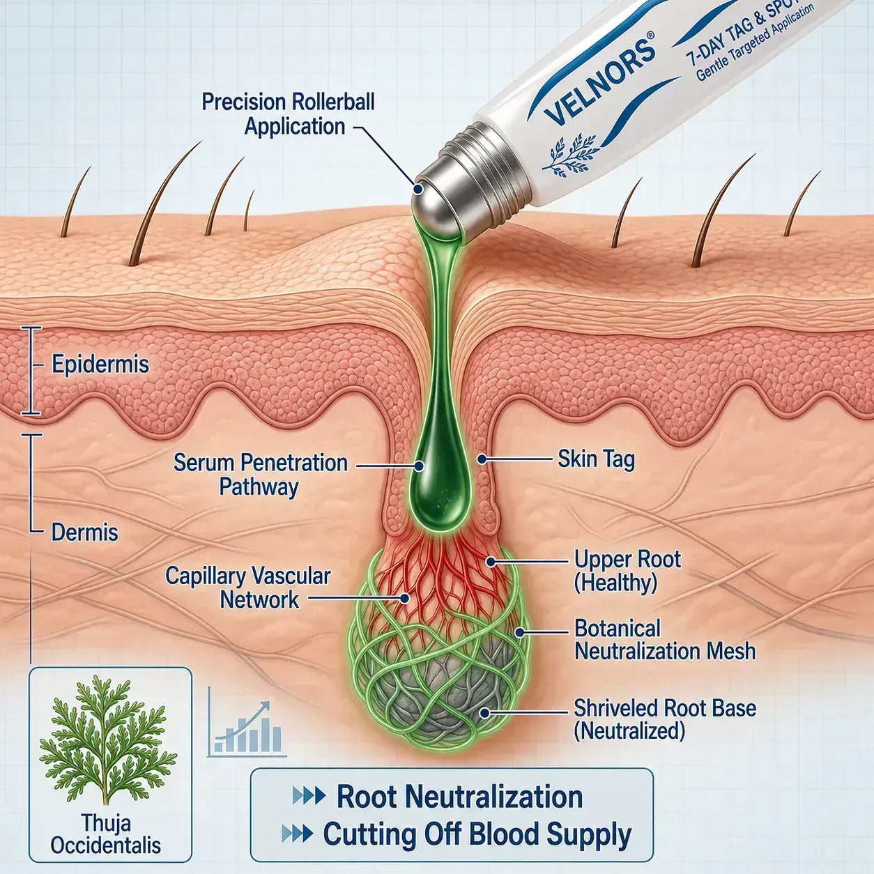 VELNORS® Painless &amp; Scar-Free Advanced Imperfection Removal Rollerball Pen
