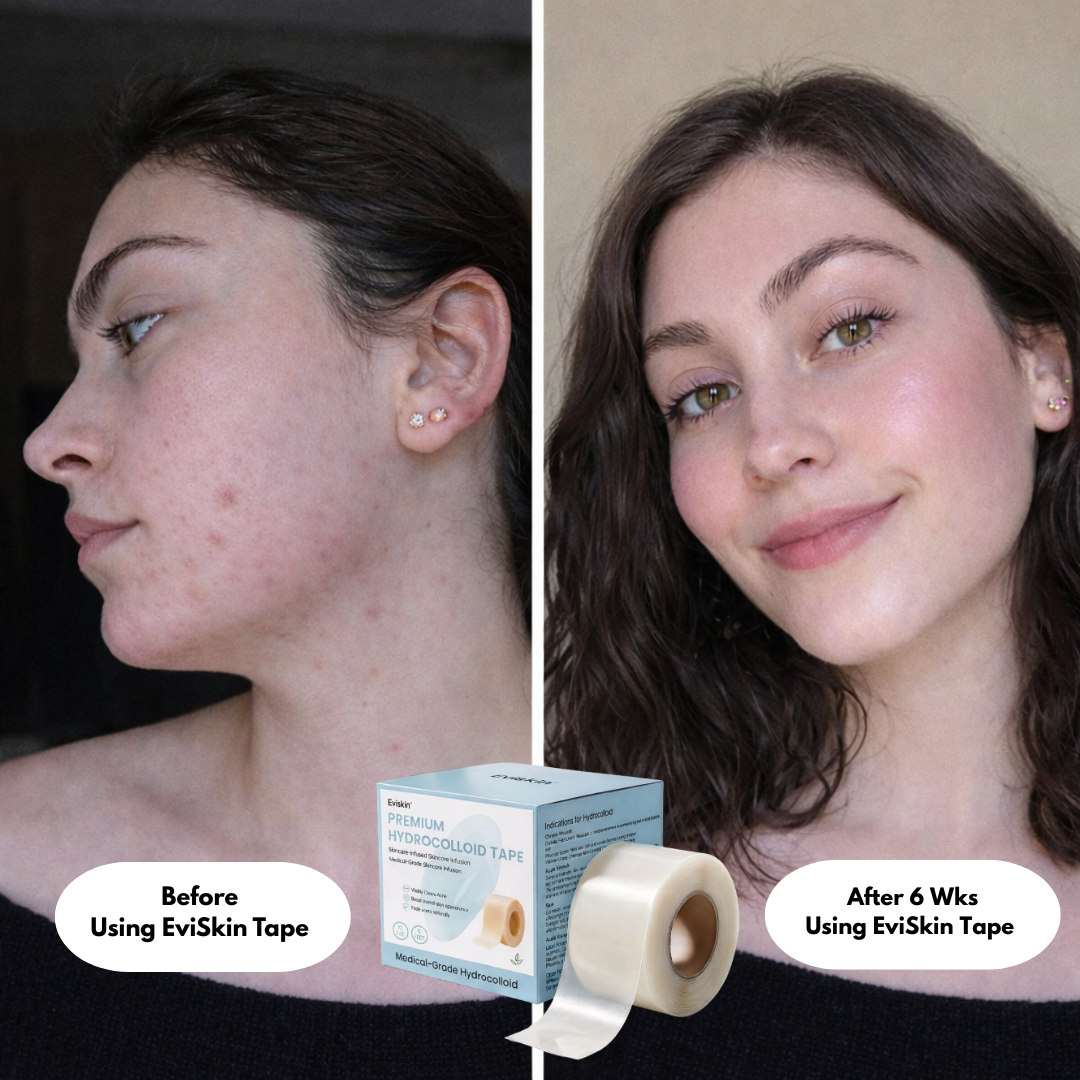 Premium Hydrocolloid Roll That Heals & Protects Your Skin