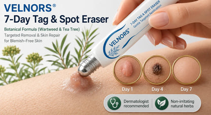 VELNORS® Painless &amp; Scar-Free Advanced Imperfection Removal Rollerball Pen
