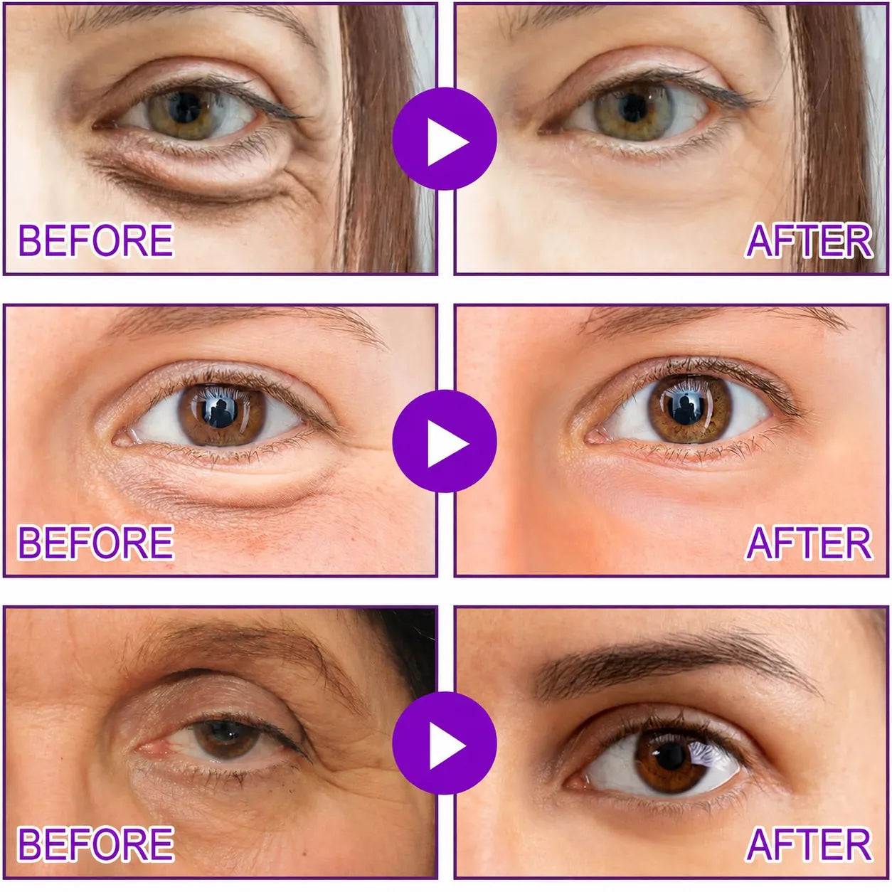 Still Waking Up With Eye Bags No Matter What You Try?