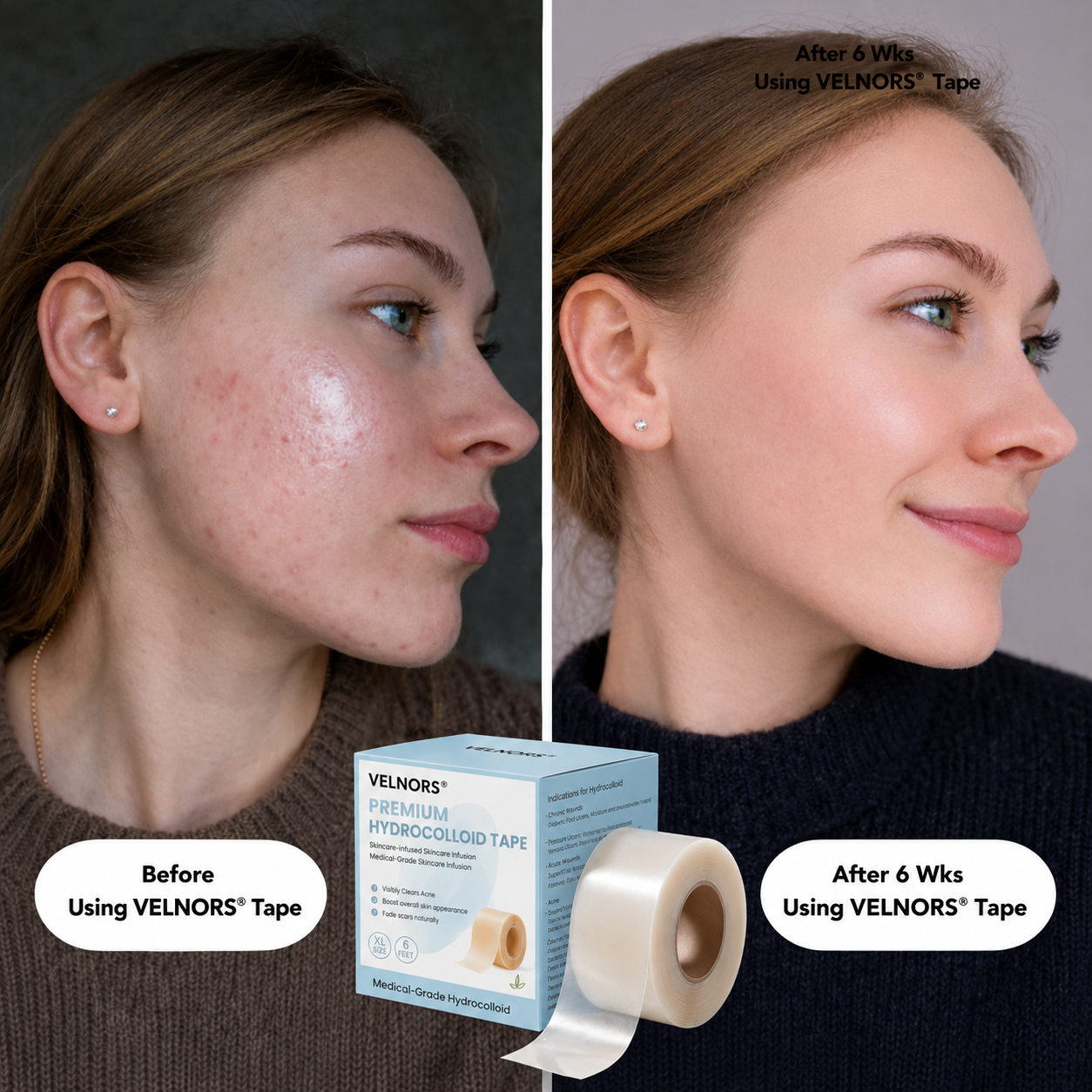 Premium Hydrocolloid Roll That Heals & Protects Your Skin