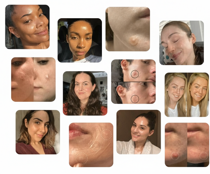 Premium Hydrocolloid Roll That Heals & Protects Your Skin
