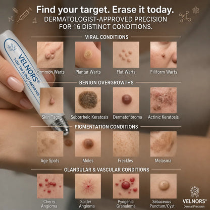 VELNORS® Painless &amp; Scar-Free Advanced Imperfection Removal Rollerball Pen